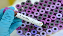 Dourados tem mais de 7 mil curados da Covid-19