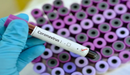 Covid: MS registra 127 novos casos e 1 óbito em uma semana
