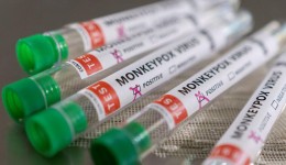 Notificação de casos da varíola dos macacos passa a ser obrigatória